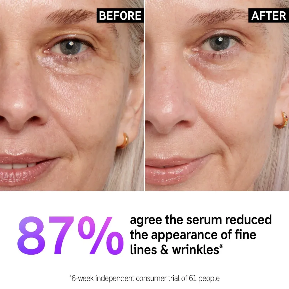 Retinol Fine Lines and Wrinkles Serum - Inkey List